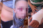 "BLIC" SAZNAJE Dečak (7) kojeg je školski drug gurnuo niz stepenice primljen u bolnicu, oglasila se majka: "STANJE MU SE POGORŠALO"